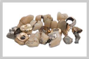 Dentalgold Ankauf zahngold-verkaufen-pasigo